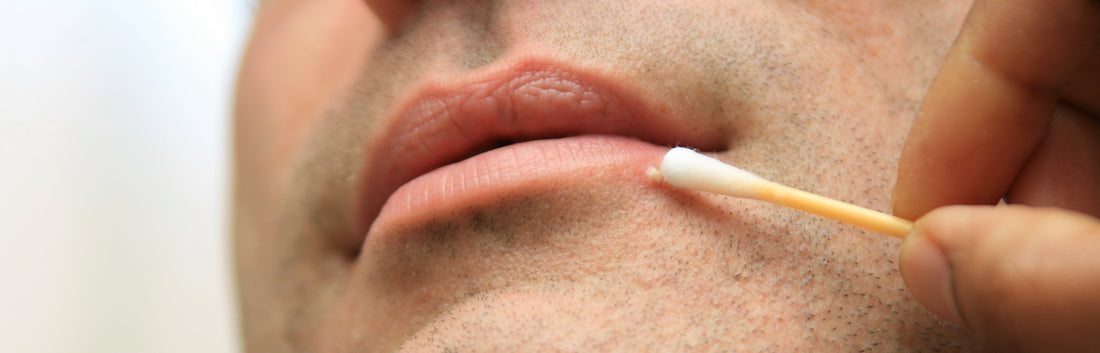Tackling Ingrown Hairs: Causes, Prevention, And Treatment Options