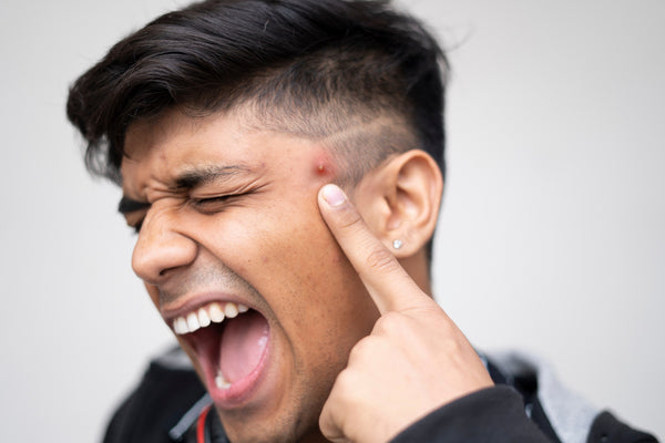 shaving with acne