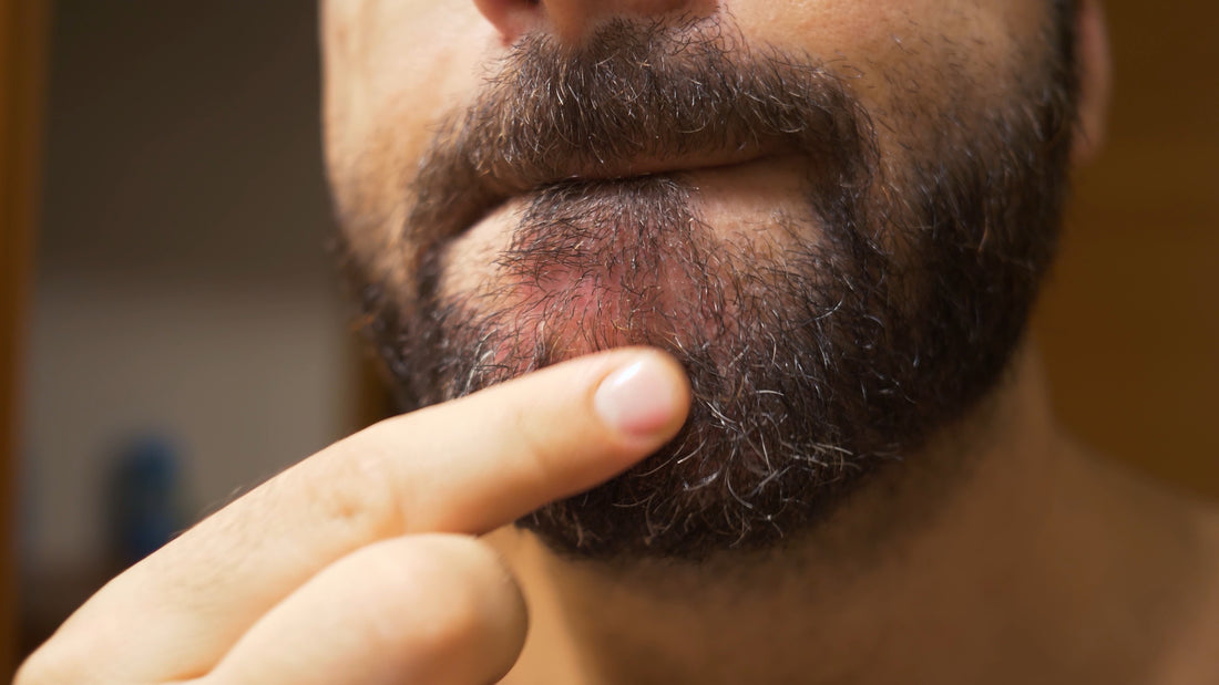 The Impact Of Hard Water On Your Facial Hair