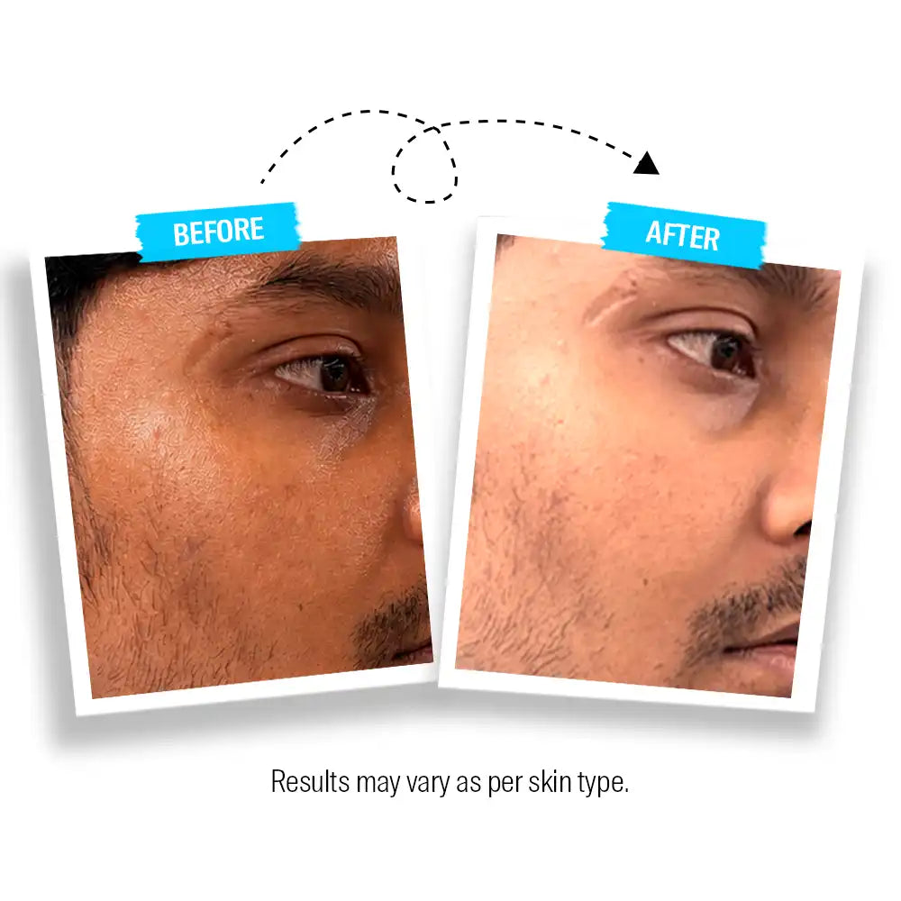 2in1 Oil Control and Brightening Face Serum