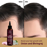 Bombay Shaving Company - Hair Growth Kit For Men and Women - Reduces Hair Fall and Boosts Hair Growth